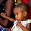 Possibly malnourished child awaiting examination, Anosy Region, Madagascar
